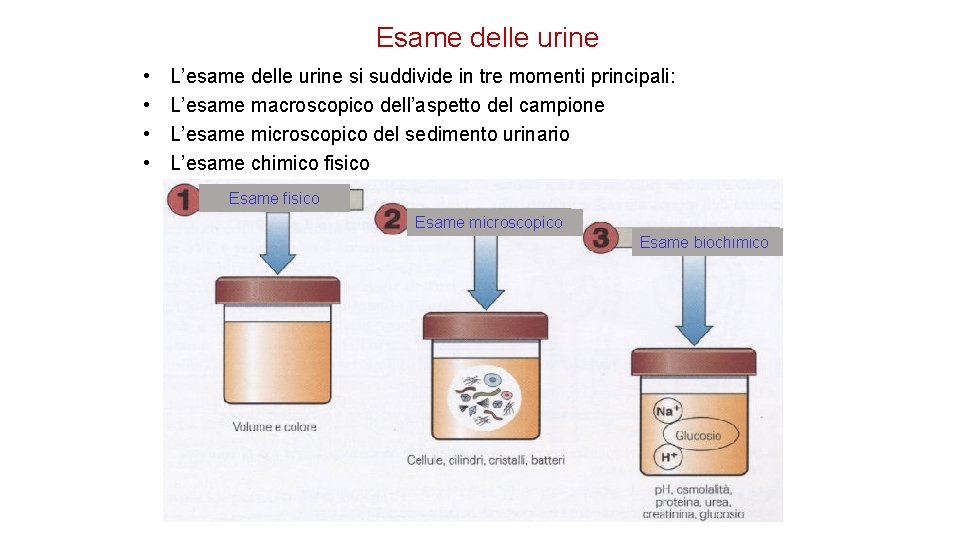 Esame delle urine • • L’esame delle urine si suddivide in tre momenti principali: