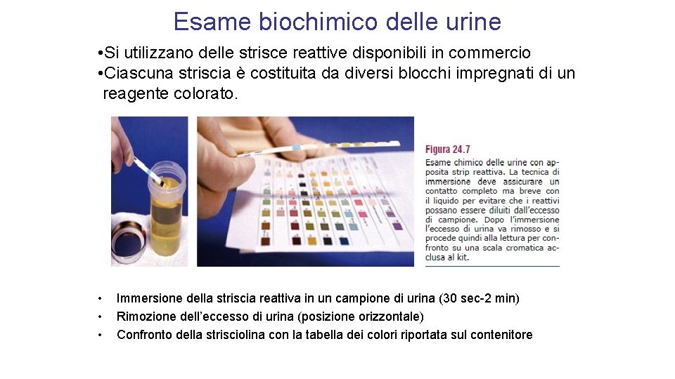 Esame biochimico delle urine • Si utilizzano delle strisce reattive disponibili in commercio •