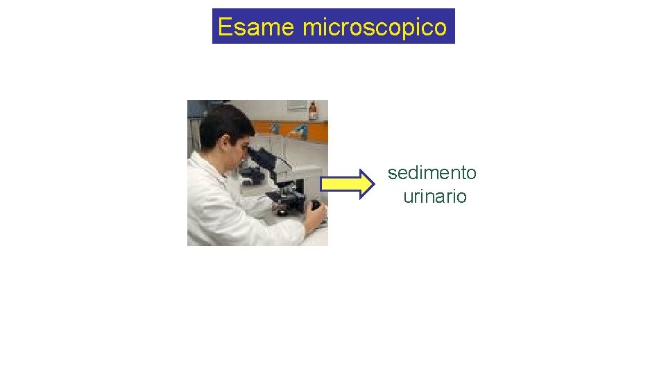 Esame microscopico sedimento urinario 