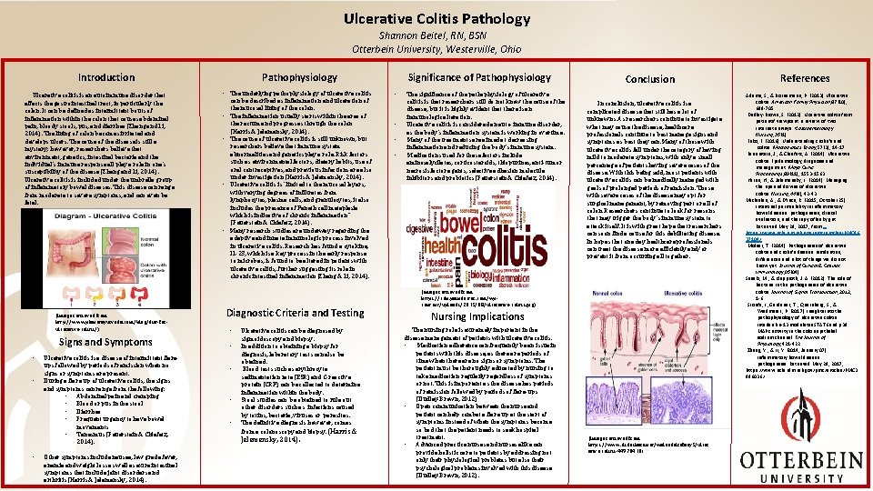 Ulcerative Colitis Pathology Shannon Beitel, RN, BSN Otterbein University, Westerville, Ohio Pathophysiology Introduction Ulcerative