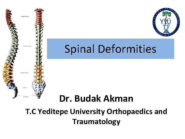 Spinal Deformities Dr. Budak Akman T. C Yeditepe University Orthopaedics and Traumatology 