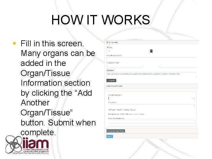 HOW IT WORKS § Fill in this screen. Many organs can be added in