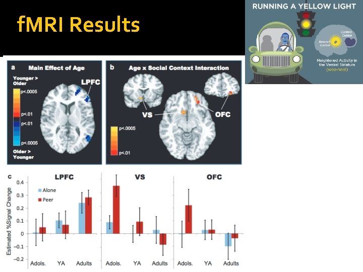 f. MRI Results 