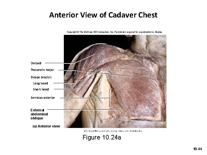Anterior View of Cadaver Chest Copyright © The Mc. Graw-Hill Companies, Inc. Permission required
