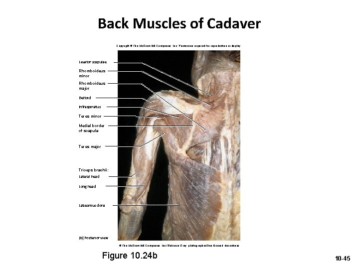 Back Muscles of Cadaver Copyright © The Mc. Graw-Hill Companies, Inc. Permission required for