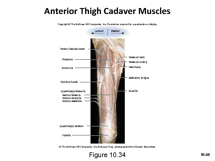 Anterior Thigh Cadaver Muscles Copyright © The Mc. Graw-Hill Companies, Inc. Permission required for