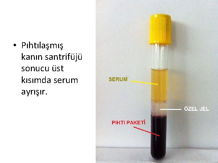  • Pıhtılaşmış kanın santrifüjü sonucu üst kısımda serum ayrışır. 