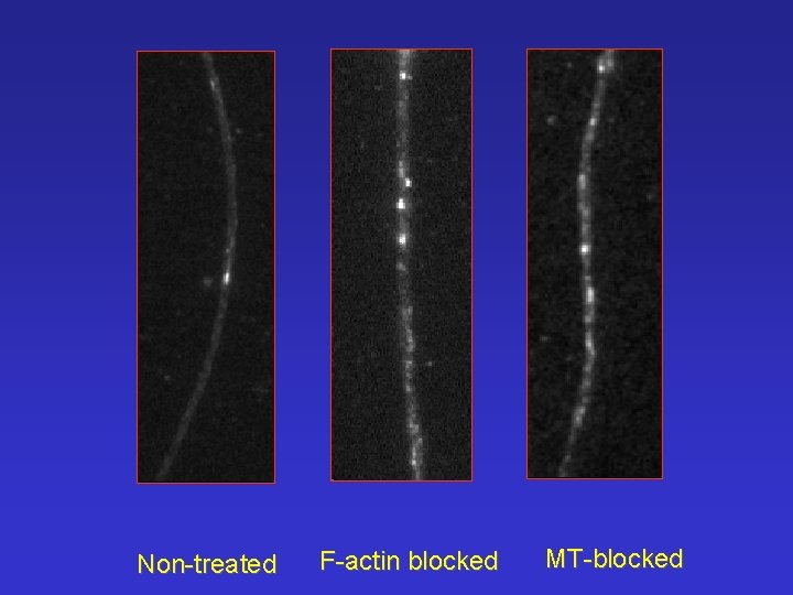 Non-treated F-actin blocked MT-blocked 