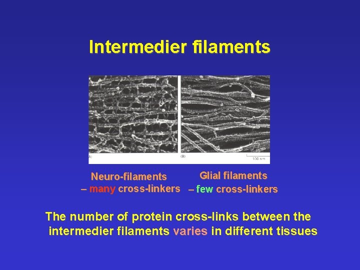 Intermedier filaments Glial filaments Neuro-filaments – many cross-linkers – few cross-linkers The number of