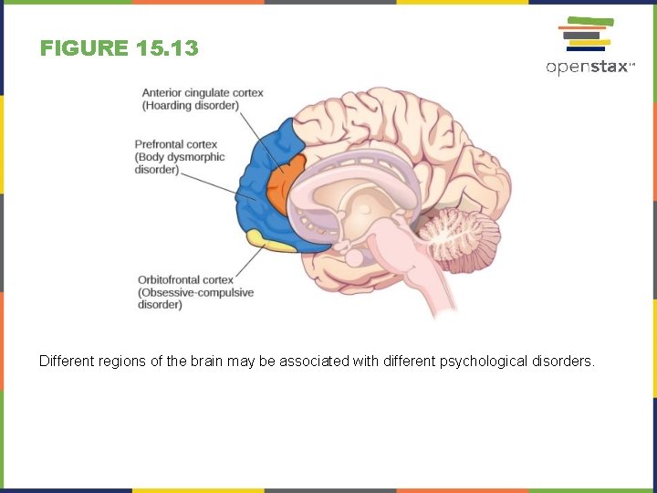 FIGURE 15. 13 Different regions of the brain may be associated with different psychological