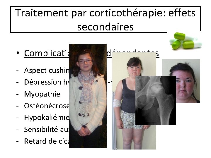 Traitement par corticothérapie: effets secondaires • Complications dose-dépendantes - Aspect cushingoïde Dépression hypothalamo-hypophysaire Myopathie