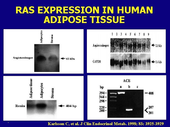 RAS EXPRESSION IN HUMAN ADIPOSE TISSUE . Karlsson C, et al. J Clin Endocrinol