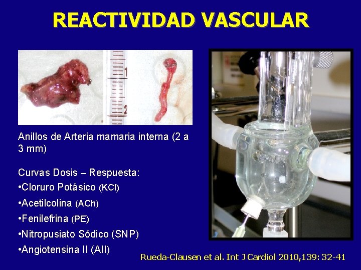 REACTIVIDAD VASCULAR Anillos de Arteria mamaria interna (2 a 3 mm) Curvas Dosis –