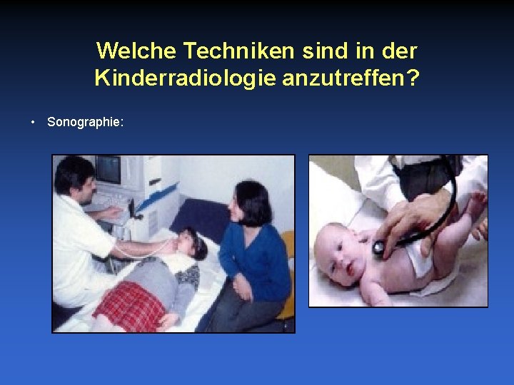 Welche Techniken sind in der Kinderradiologie anzutreffen? • Sonographie: 