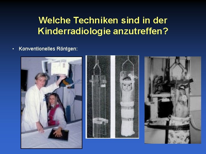 Welche Techniken sind in der Kinderradiologie anzutreffen? • Konventionelles Röntgen: 