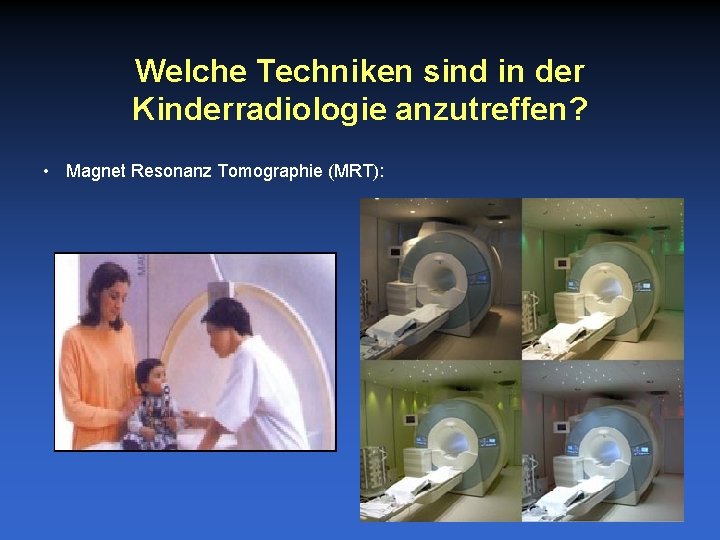 Welche Techniken sind in der Kinderradiologie anzutreffen? • Magnet Resonanz Tomographie (MRT): 