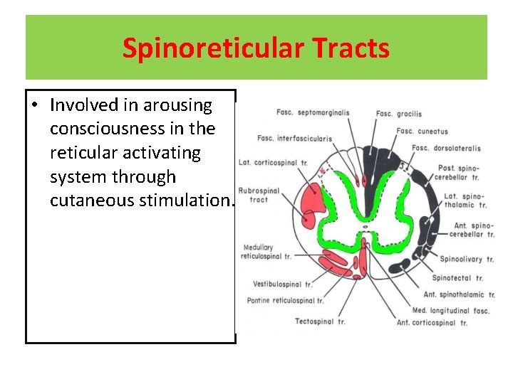 Spinoreticular Tracts • Involved in arousing consciousness in the reticular activating system through cutaneous