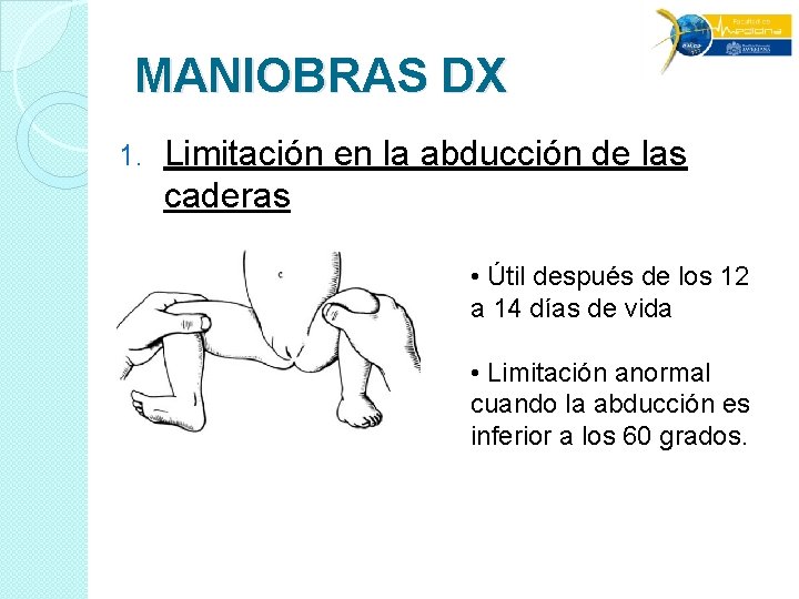 MANIOBRAS DX 1. Limitación en la abducción de las caderas • Útil después de MANIOBRAS DX 1. Limitación en la abducción de las caderas • Útil después de
