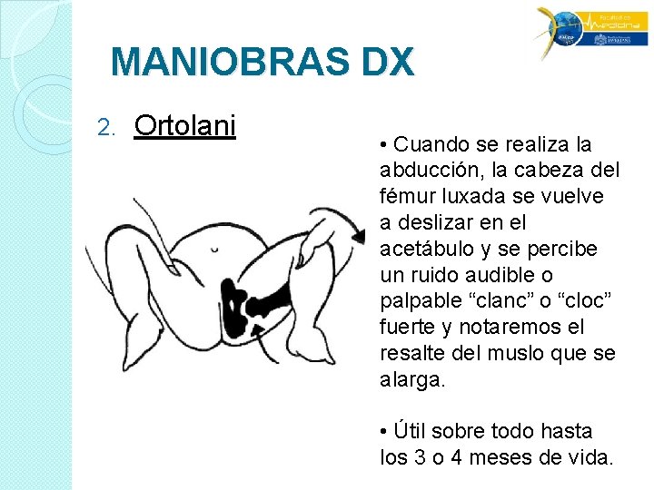 MANIOBRAS DX 2. Ortolani • Cuando se realiza la abducción, la cabeza del fémur MANIOBRAS DX 2. Ortolani • Cuando se realiza la abducción, la cabeza del fémur