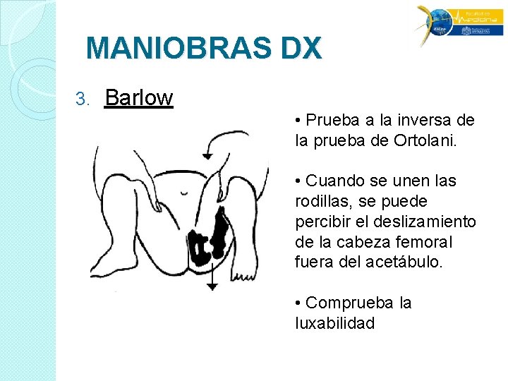 MANIOBRAS DX 3. Barlow • Prueba a la inversa de la prueba de Ortolani. MANIOBRAS DX 3. Barlow • Prueba a la inversa de la prueba de Ortolani.