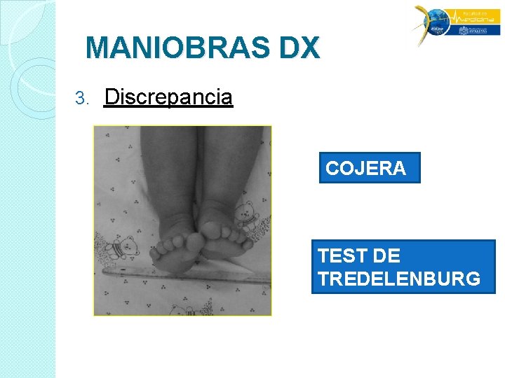 MANIOBRAS DX 3. Discrepancia COJERA TEST DE TREDELENBURG MANIOBRAS DX 3. Discrepancia COJERA TEST DE TREDELENBURG