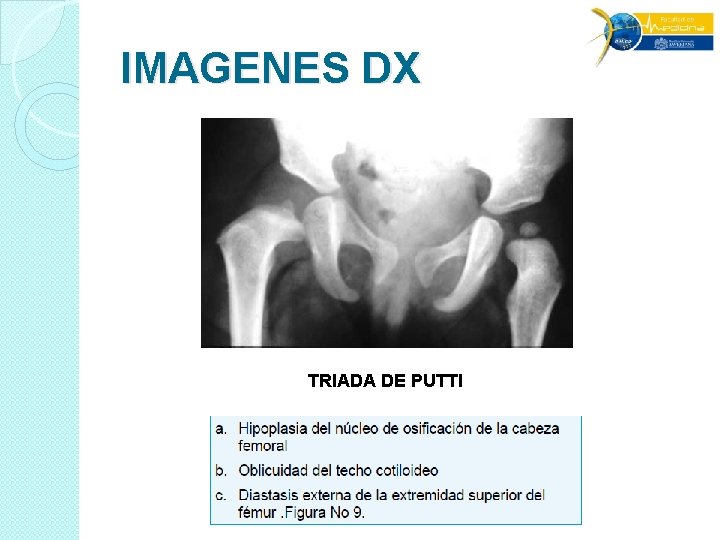 IMAGENES DX TRIADA DE PUTTI IMAGENES DX TRIADA DE PUTTI