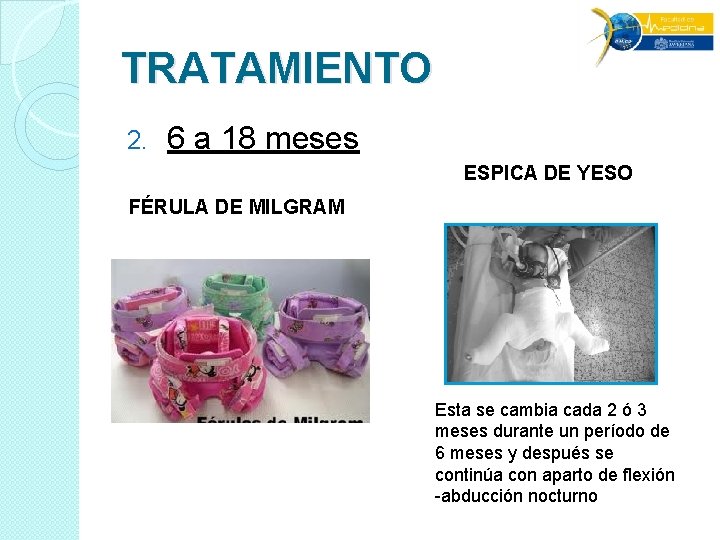 TRATAMIENTO 2. 6 a 18 meses ESPICA DE YESO FÉRULA DE MILGRAM Esta se TRATAMIENTO 2. 6 a 18 meses ESPICA DE YESO FÉRULA DE MILGRAM Esta se