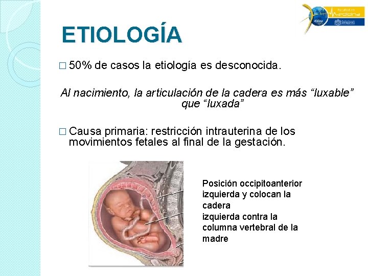 ETIOLOGÍA � 50% de casos la etiología es desconocida. Al nacimiento, la articulación de ETIOLOGÍA � 50% de casos la etiología es desconocida. Al nacimiento, la articulación de