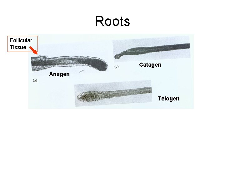 Roots Follicular Tissue Catagen Anagen Telogen 