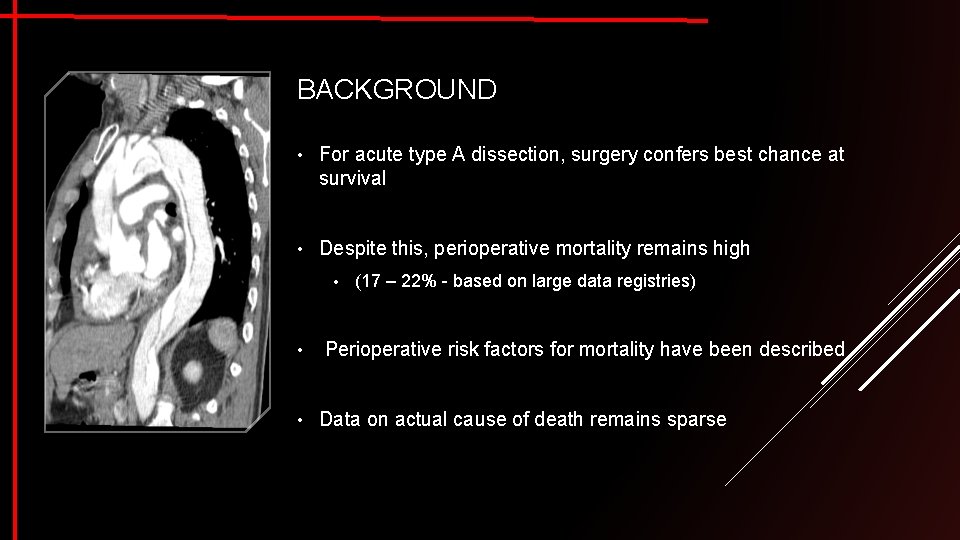 BACKGROUND • For acute type A dissection, surgery confers best chance at survival •