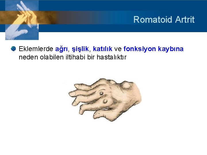 Romatoid Artrit Eklemlerde ağrı, şişlik, katılık ve fonksiyon kaybına neden olabilen iltihabi bir hastalıktır