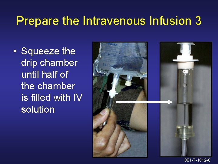 Prepare the Intravenous Infusion 3 • Squeeze the drip chamber until half of the