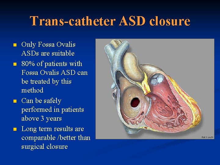 Trans-catheter ASD closure n n Only Fossa Ovalis ASDs are suitable 80% of patients