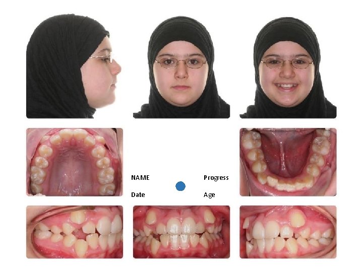 NAME Progress Date Age 