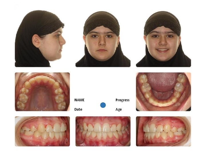 NAME Progress Date Age 