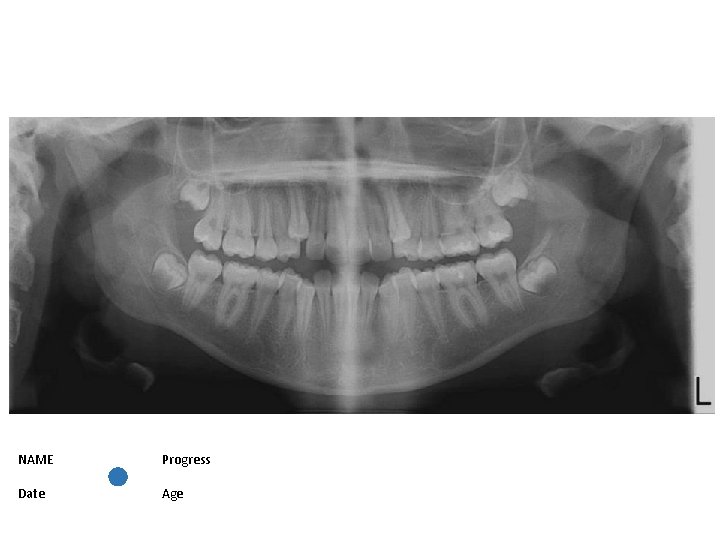 NAME Progress Date Age 