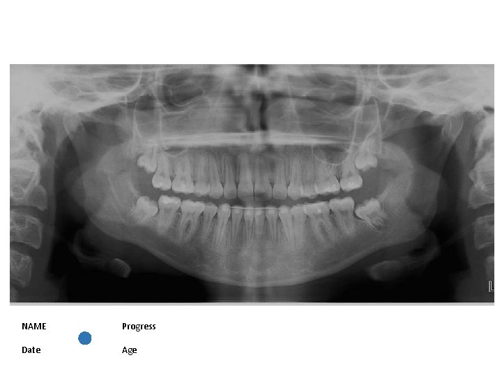 NAME Progress Date Age 