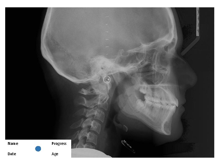 Name Progress Date Age 