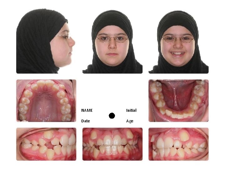 NAME Initial Date Age 