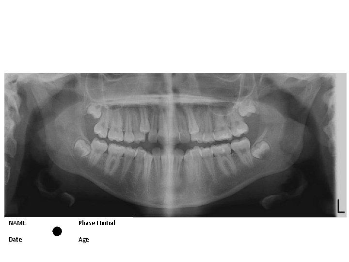 NAME Phase I Initial Date Age 