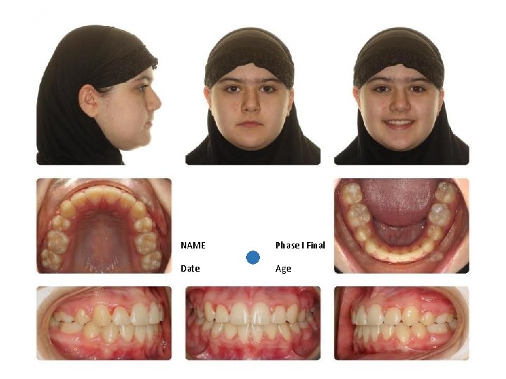 NAME Phase I Final Date Age 
