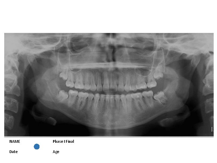 NAME Phase I Final Date Age 