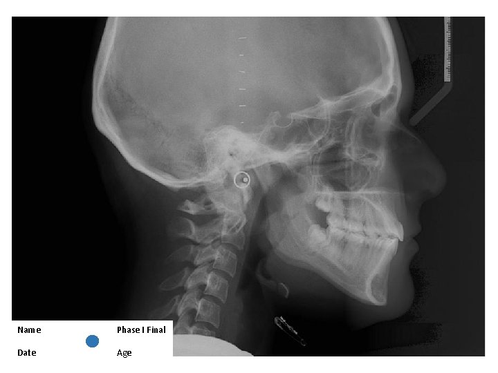 Name Phase I Final Date Age 