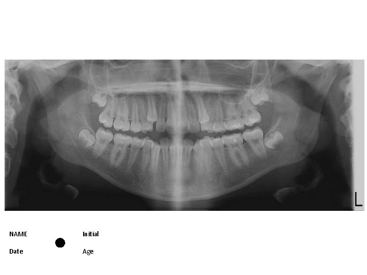 NAME Initial Date Age 