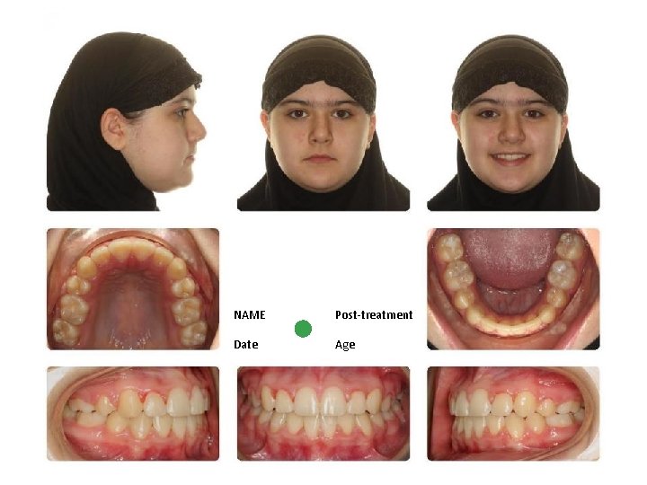 NAME Post-treatment Date Age 
