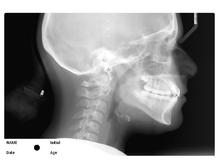 NAME Initial Date Age 