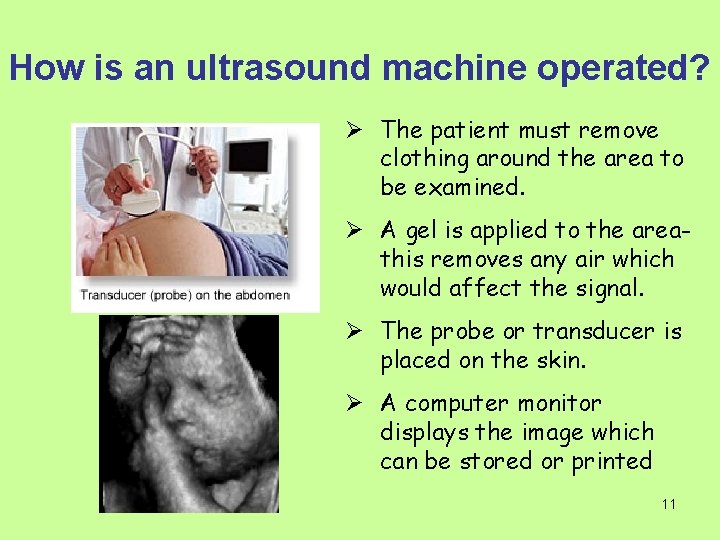 How is an ultrasound machine operated? Ø The patient must remove clothing around the
