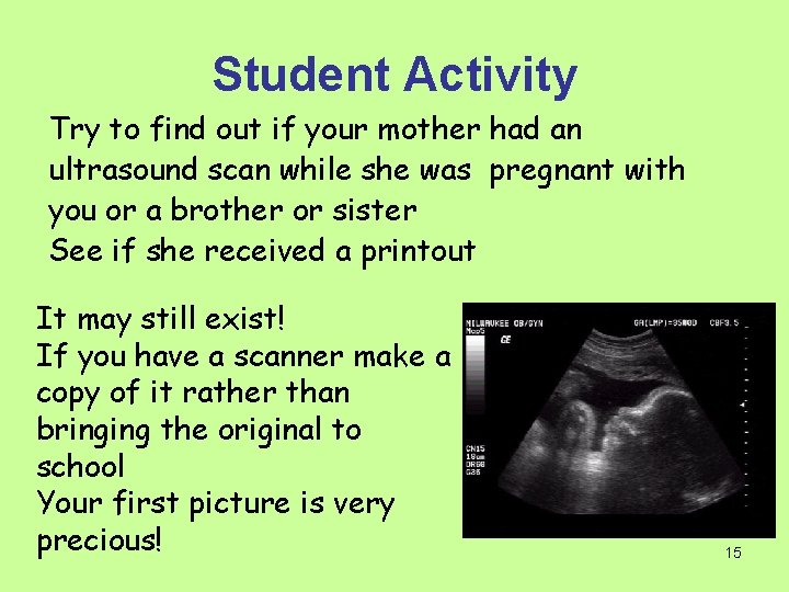 Student Activity Try to find out if your mother had an ultrasound scan while
