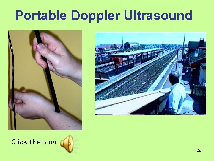Portable Doppler Ultrasound Click the icon 26 