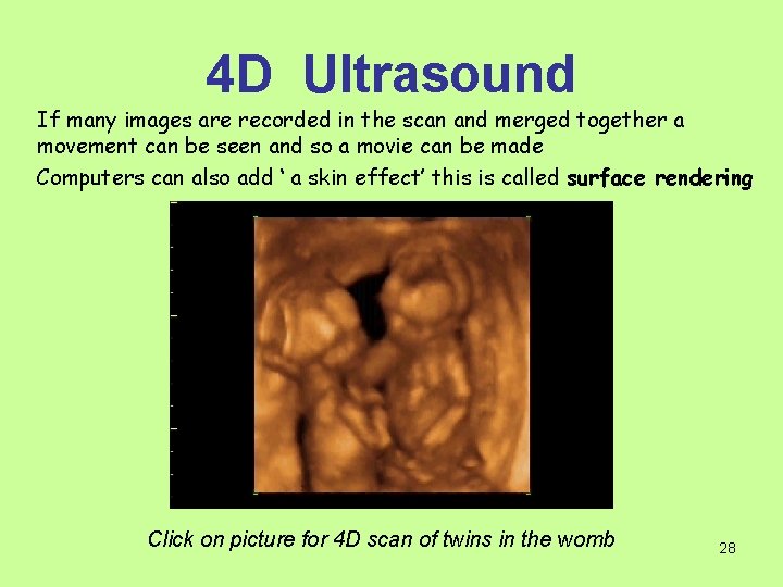 4 D Ultrasound If many images are recorded in the scan and merged together